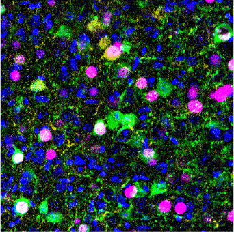 Fluorescence image of prefrontal cortex: memory encoding neurons in green, cortically projecting neurons in yellow, and memory recall–active neurons in magenta.