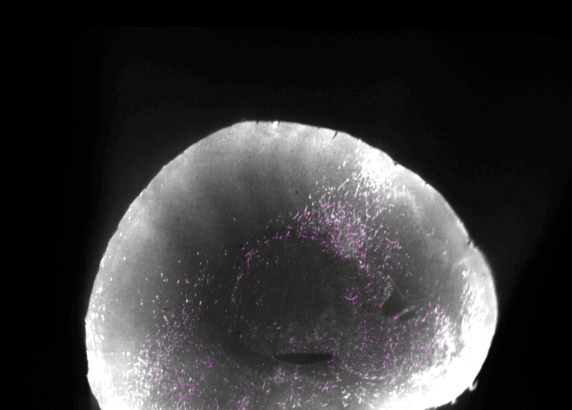 Prelimbic cortex slice from whole-brain imaging.